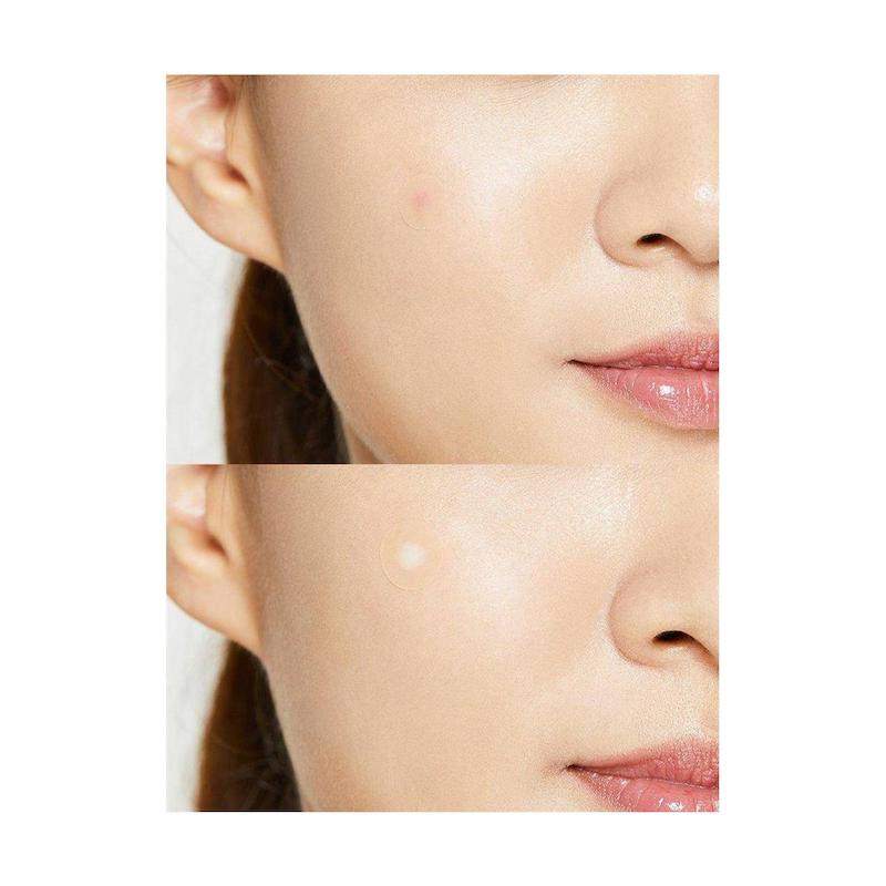 پچ‌های ضد جوش کوزارکس مدل Acne Pimple Master Patch بسته 24 عددی